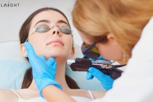 Laser Hair Removal Market