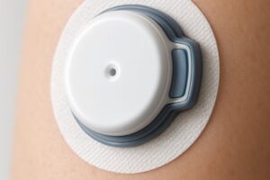 continuous blood glucose monitors