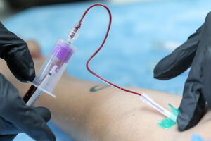 Can I Eat Before a Home Blood Test at Home in Dubai? Guidelines