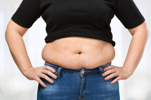 Fat Melting Injections in Dubai