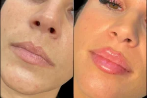 Best Aesthetic Clinics in dubai
