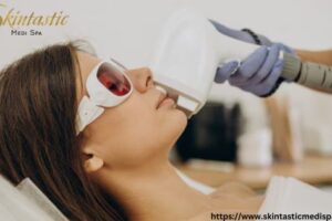 Laser Hair Removal in Riverside