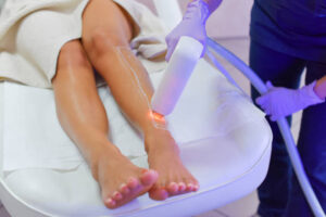 Laser Hair Removal in Riyadh | Smooth Skin with Lasting Results