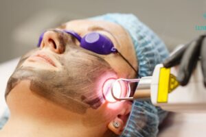 Laser Treatment Costs in Dubai