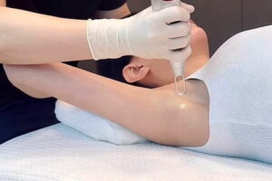 Underarm Whitening Treatments in Dubai