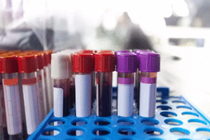 How Long Does a Home Blood Test in Dubai Take?