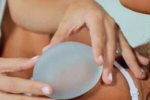 Breast Enlargement Dubai