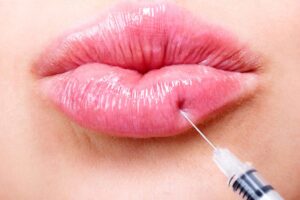 Juvederm Fillers in Dubai