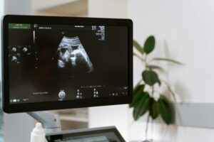 CT Scan vs MRI