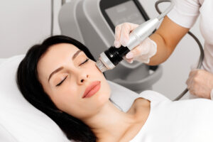 Fractional RF Microneedling