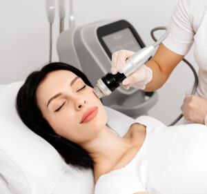 Fractional RF Microneedling