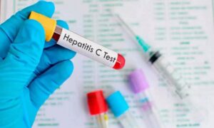 Hepatitis C Test in Dubai