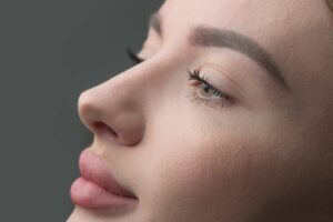 Rhinoplasty