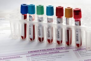 Blood Test at Home for Energy Levels