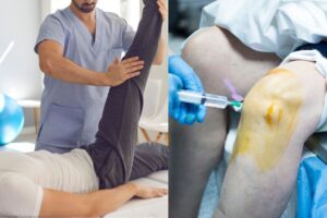 Physiotherapy vs Surgery What’s Best for Your Orthopedic Injury