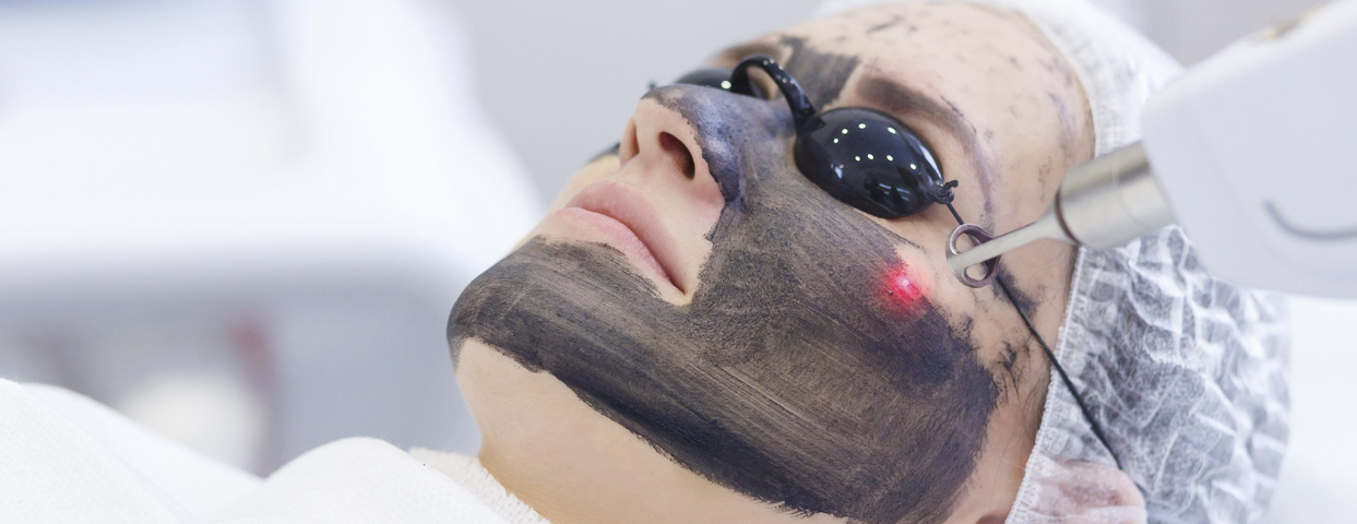 Carbon Peel Facial – The Secret to Oil-Free, Radiant & Even-Toned Skin