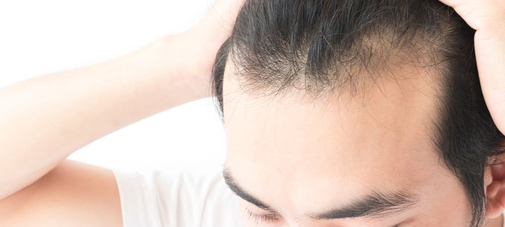 Hair Transplant in Riyadh