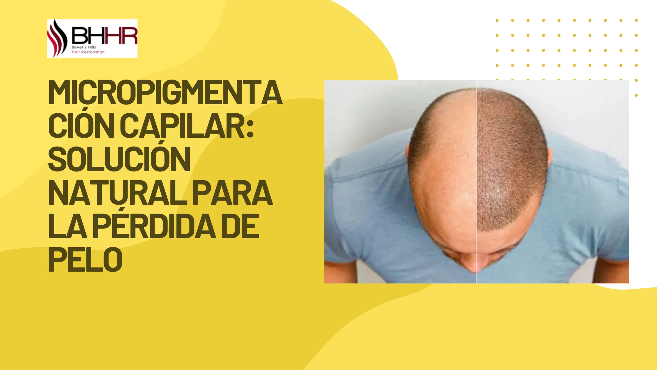 tratamiento de micropigmentacion capilar
