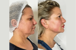 Best Aesthetic Clinic in Dubai for Laser Treatments