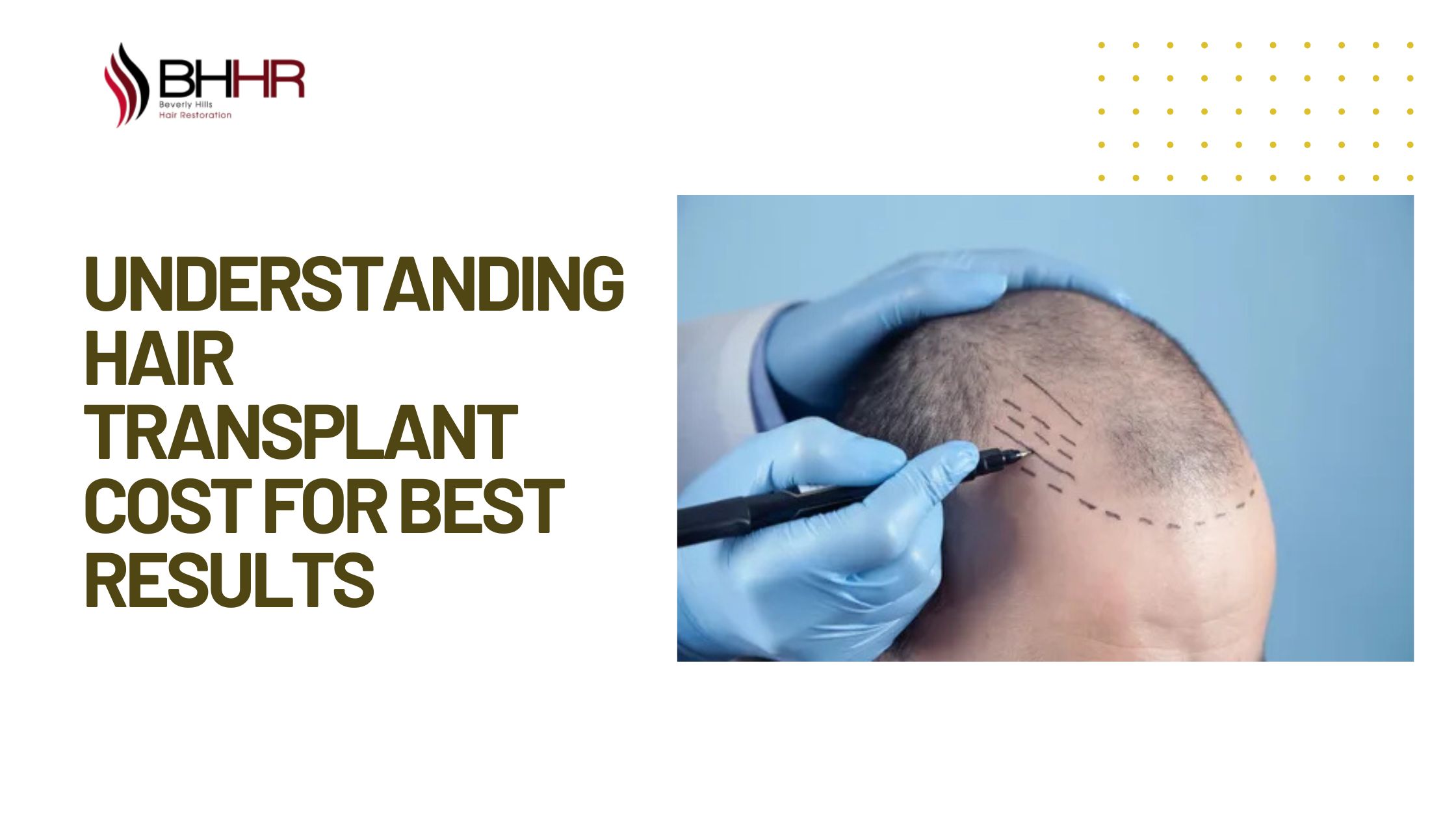 Understanding Hair Transplant Cost for Best Results
