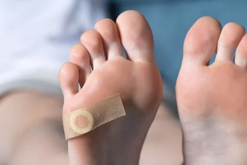 Genetics & Ingrown Toenails: When Family History Matters & What You Can Do About