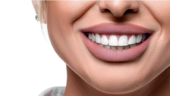 Hollywood Smile in Dubai