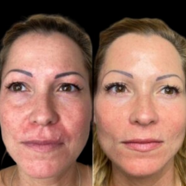 Best Aesthetic Clinic in dubai