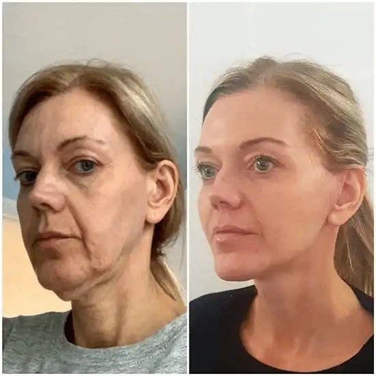 Best Aesthetic Clinic in dubai