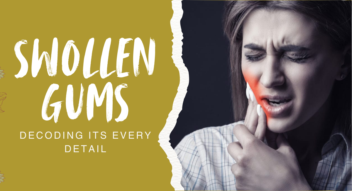 swollen gums treatment in London