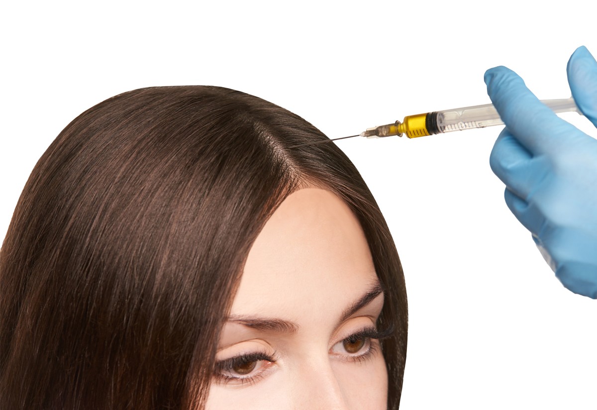 exosomes for hair loss